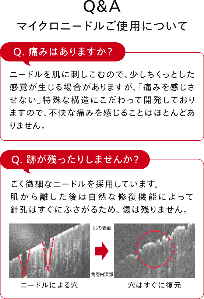 Q&A 痛みはありますか？跡が残ったりしませんか？